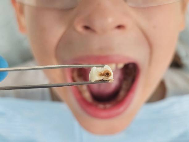 Best Urgent Tooth Repair  in Mount Pleasant, UT
